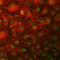 cellules MC3T3 en microscopie confocale : histones en vert, microtubules en rouge (Béatrice BOUVARD, ROB) 