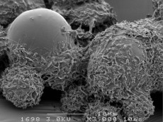 Cellules mésenchymateuses adhérées à des microparticules de PLGA en MEB (Elisa GARBAYO / MINT)
