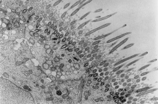 cellule ciliée en MET (Marie-Françoise MOREAU / ROB)