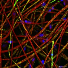calcification de microfibres de polymère par des cellules en microscopie confocale (Lisa TERRANOVA, GEROM) 